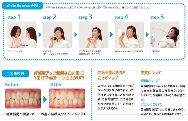 White Balanceの流れ